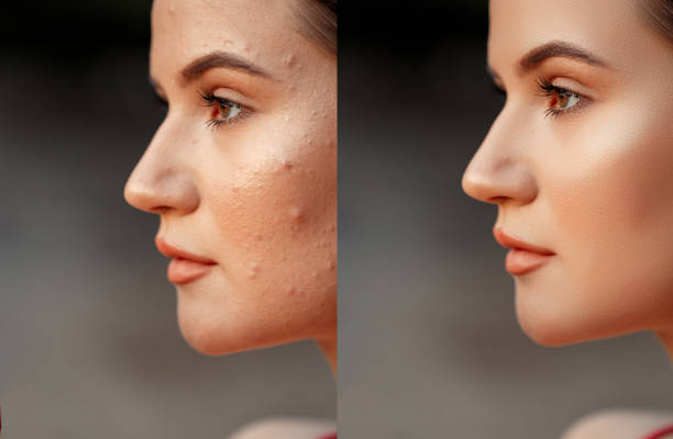 flawless portraits